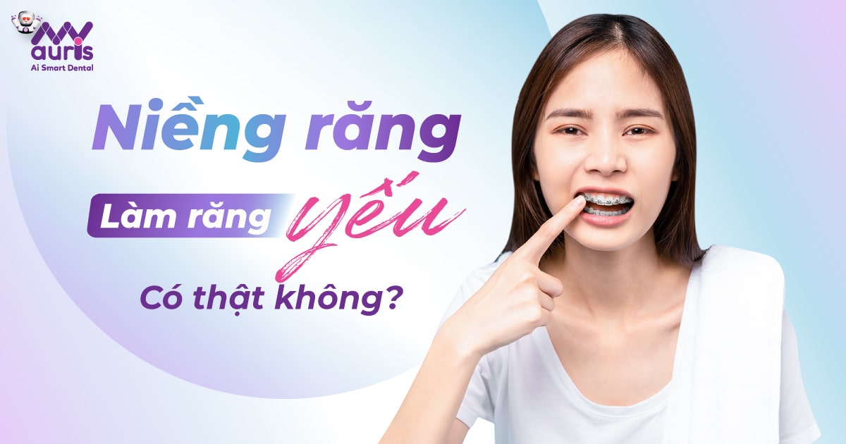 niềng răng làm răng yếu