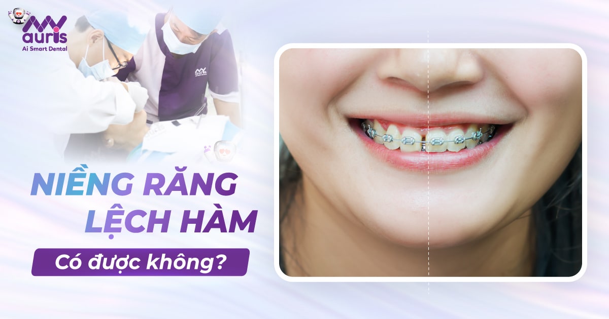 niềng răng làm răng yếu