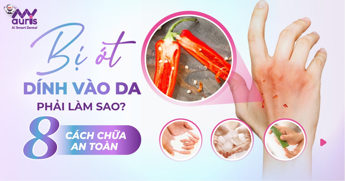 bị ớt dính vào da phải làm sao