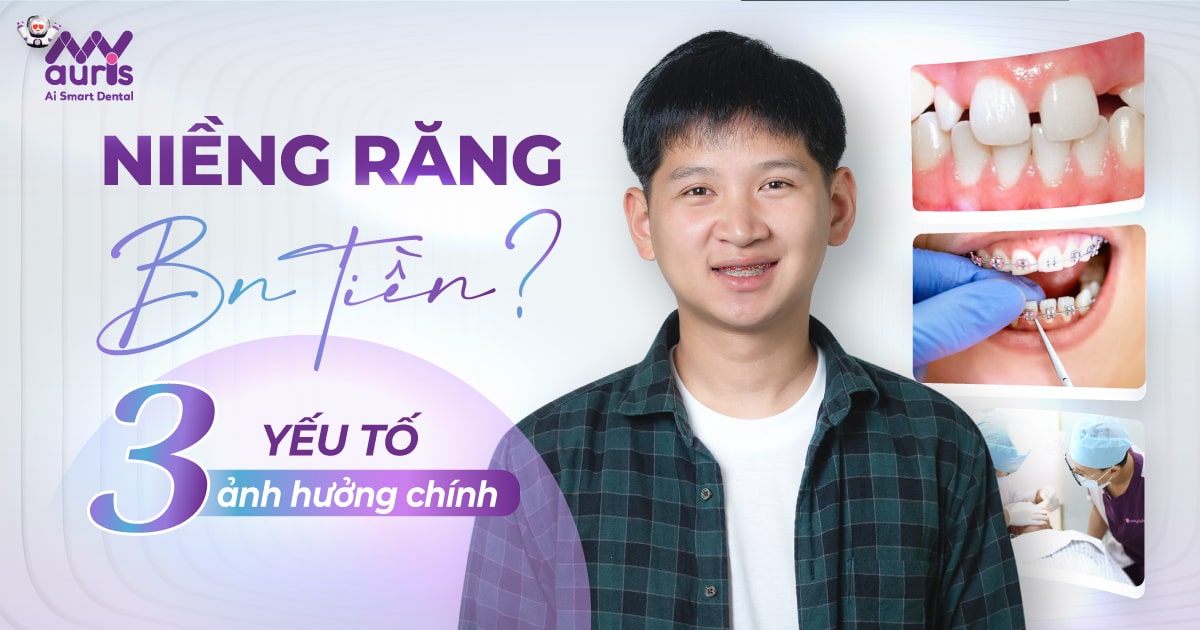 niềng răng bn tiền