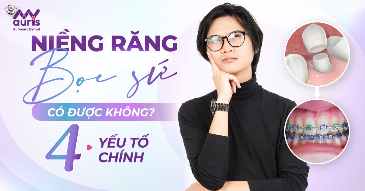 niềng răng bọc sứ