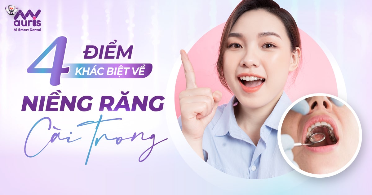 niềng răng cài trong