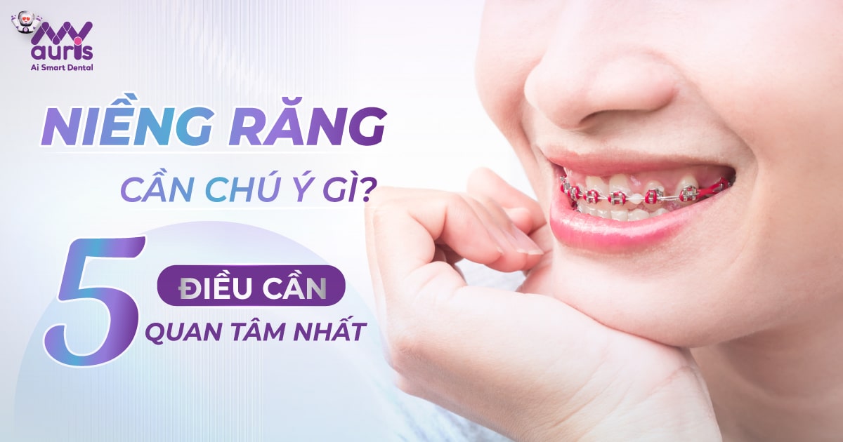 niềng răng cần chú ý gì