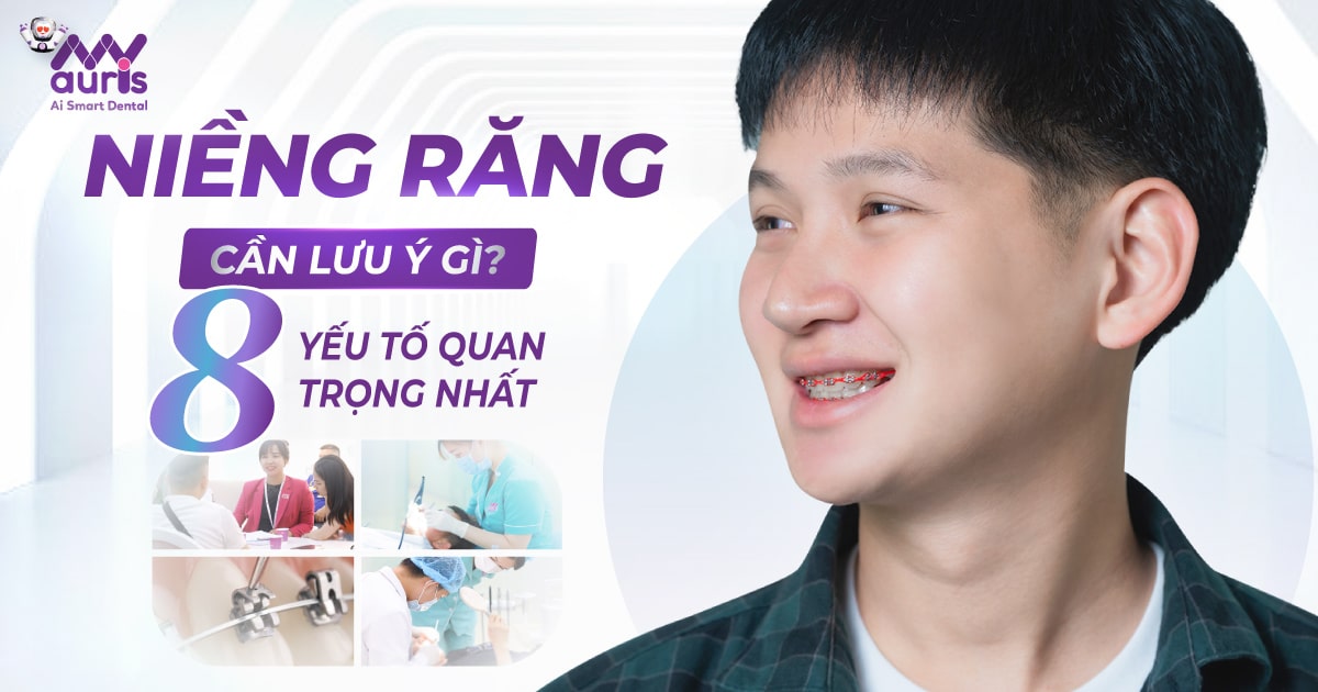 niềng răng cần lưu ý gì