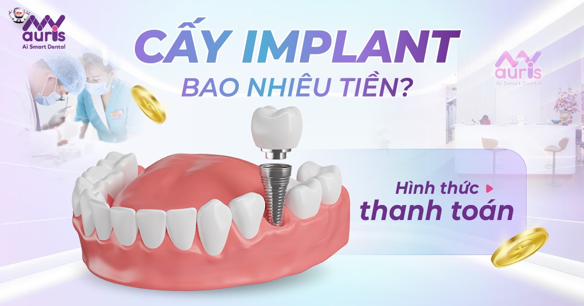 cấy implant bao nhiêu