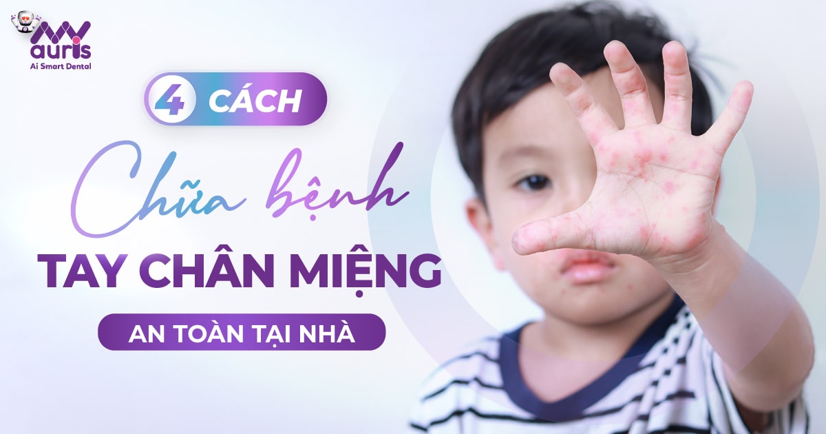 cách chữa bệnh chân tay miệng