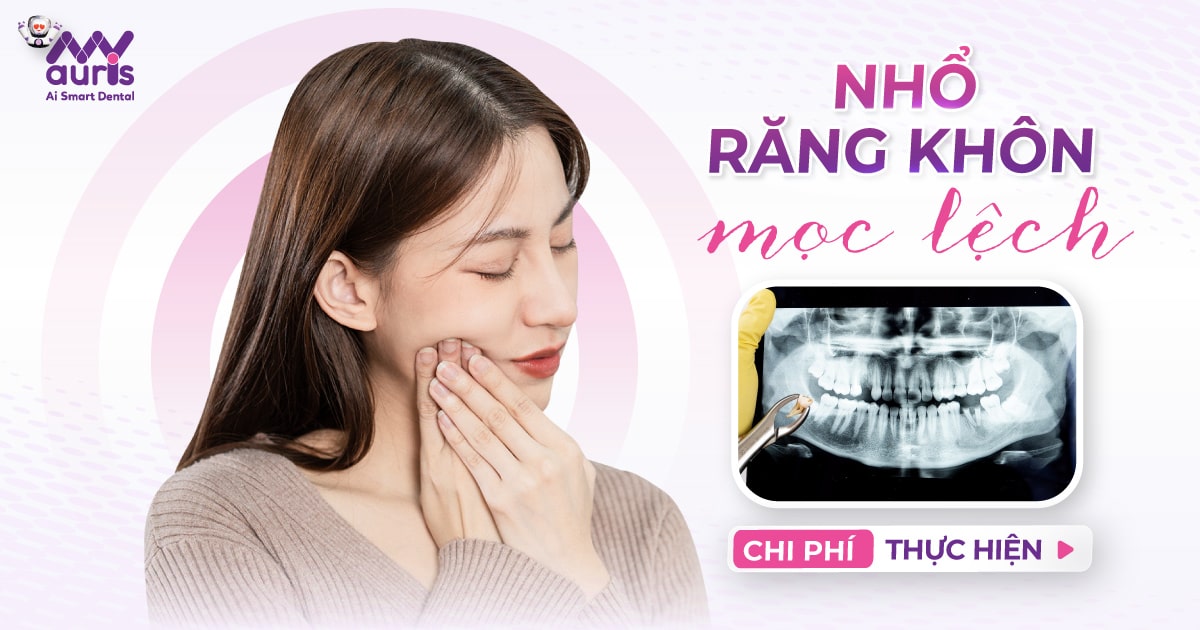 Bảng giá nhổ răng khôn mọc lệch - 3 yếu tố ảnh hưởng