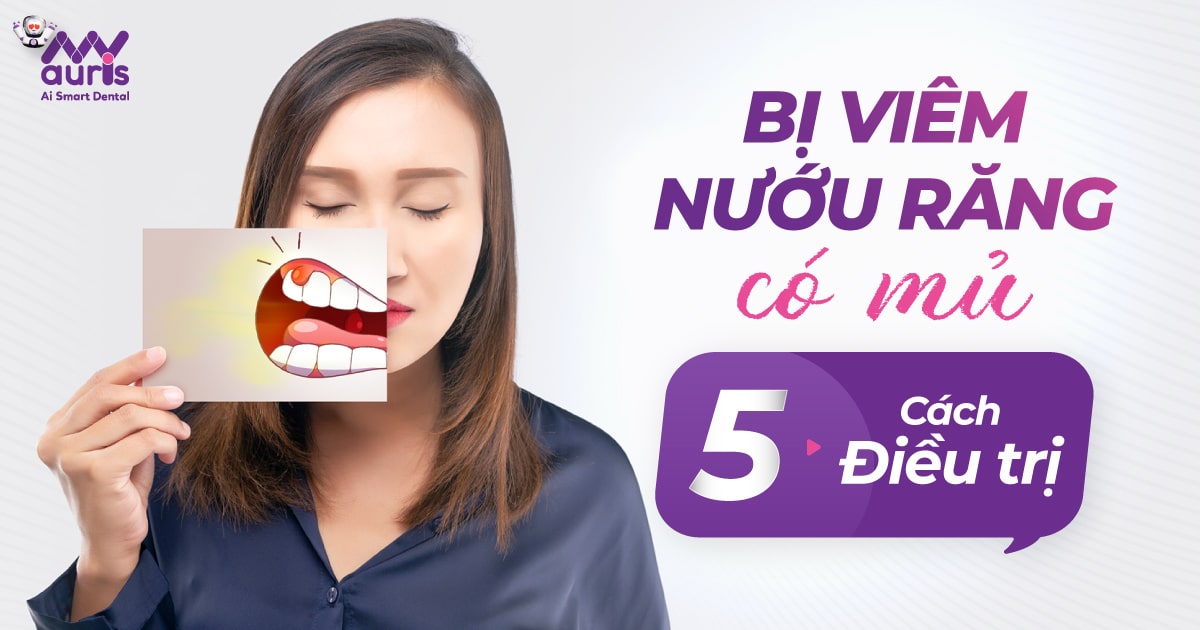 Bị viêm nướu răng có mủ