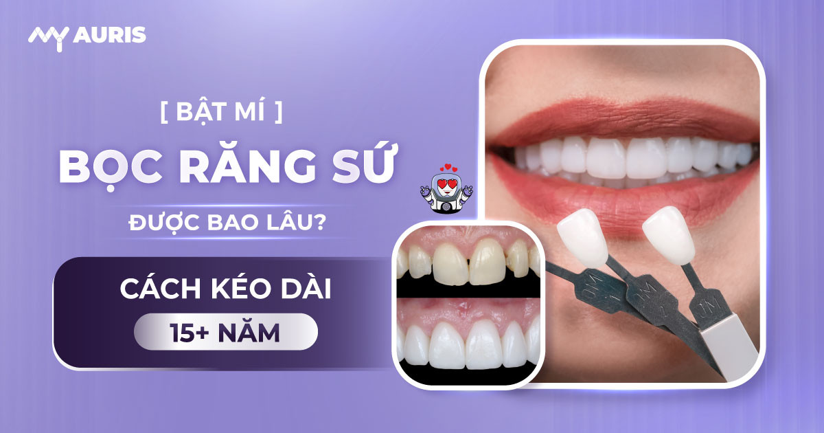 bọc răng sứ được bao lâu,bọc răng sứ xài được bao lâu,bọc răng sứ giữ được bao nhiêu năm,bọc răng sứ bao lâu thì phải làm lại