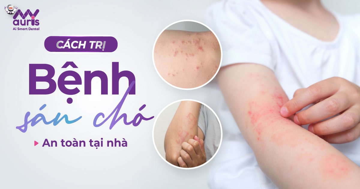 Cách trị bệnh sán chó tại nhà (3 bài thuốc dân gian)