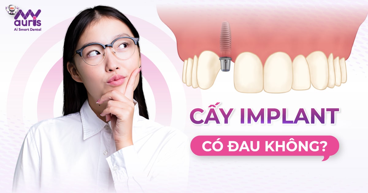 Cấy ghép Implant có đau không? (Lời khuyên từ bác sĩ)