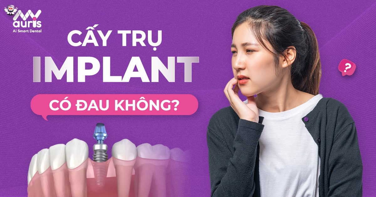 Cấy trụ Implant có đau không? 5 điểm gây ảnh hưởng