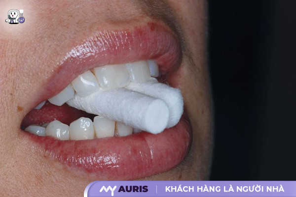 chăm sóc răng sau khi cắm implant,chăm sóc sau cấy implant