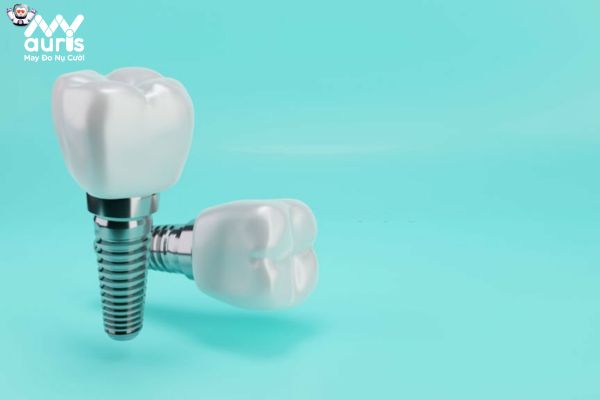 Tìm hiểu làm răng Implant là như thế nào?