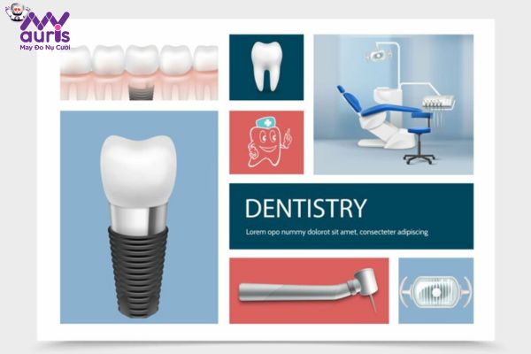 Một số yếu tố ảnh hưởng đến độ bền của trụ răng Implant 