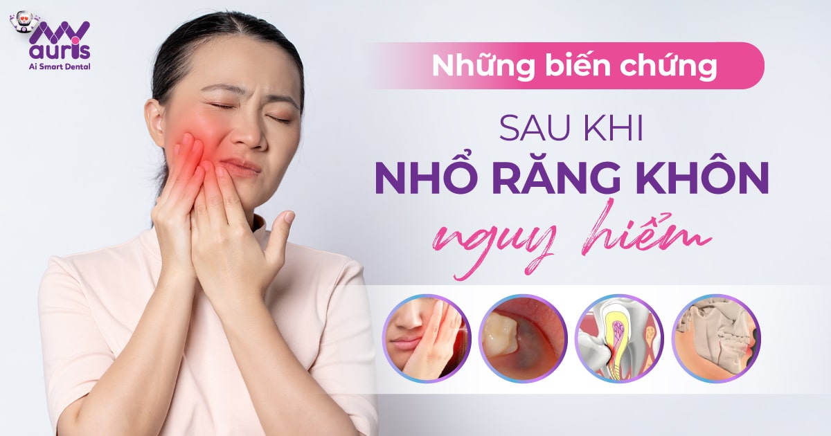 Những biến chứng sau khi nhổ răng khôn nguy hiểm