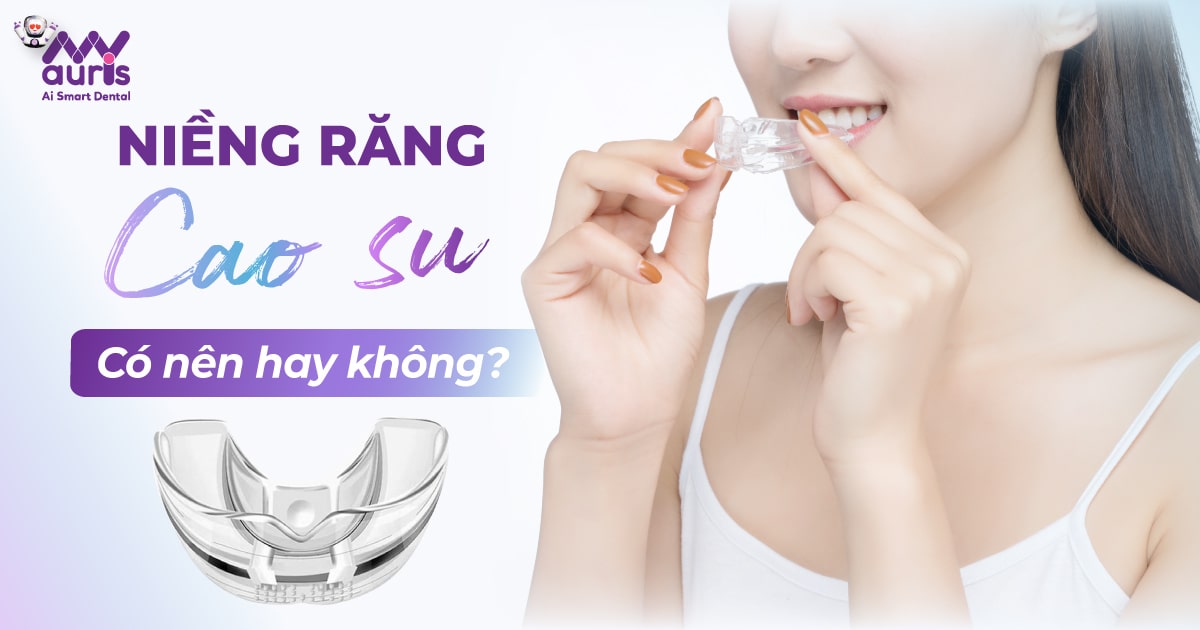 Niềng răng cao su có nên hay không?