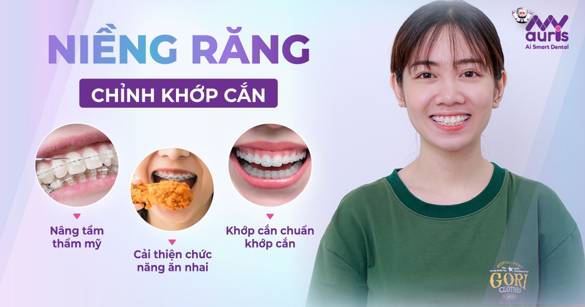 Niềng răng chỉnh khớp cắn