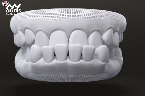 Biểu hiện của tình trạng răng móm 