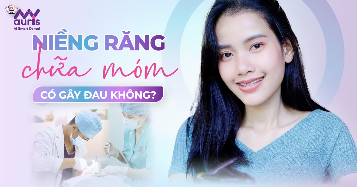 [Giải đáp] Niềng răng chữa móm có gây đau không?