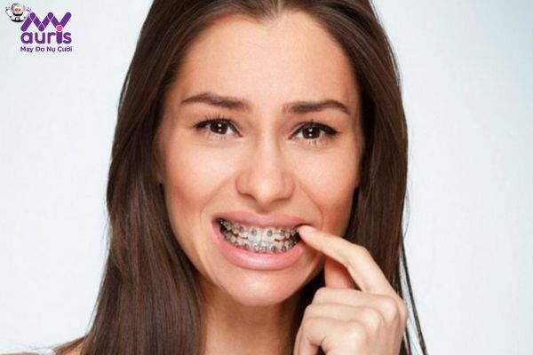 Tìm hiểu niềng răng có bị đau không?