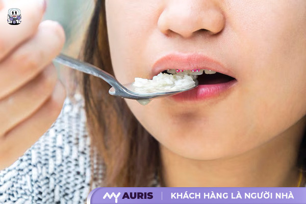 niềng răng cần kiêng gì,niềng răng có kiêng gì không