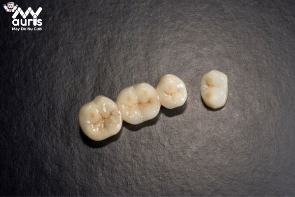Chất lượng của dòng răng sứ 1 triệu có tốt không?
