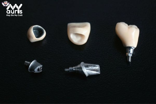 Răng sứ titan cũng thuộc dòng răng sứ có mức giá 1 triệu trở lên 