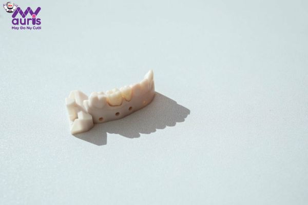 Nguồn gốc xuất xứ của dòng răng sứ Ceramic
