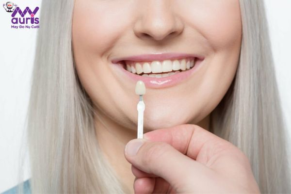 Răng sứ không kim loại có tốt không?