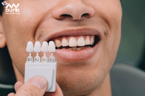 Một số tiêu chuẩn đánh giá răng sứ nam phù hợp