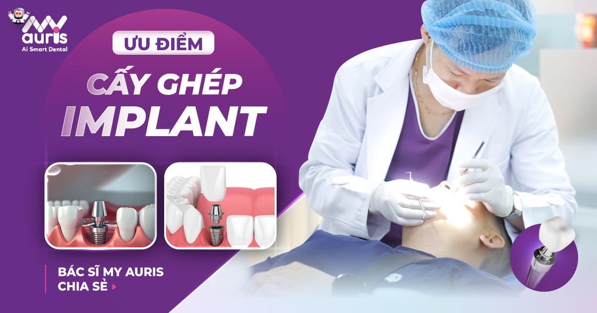 7 ưu điểm cấy ghép Implant (Bác sĩ My Auris chia sẻ)