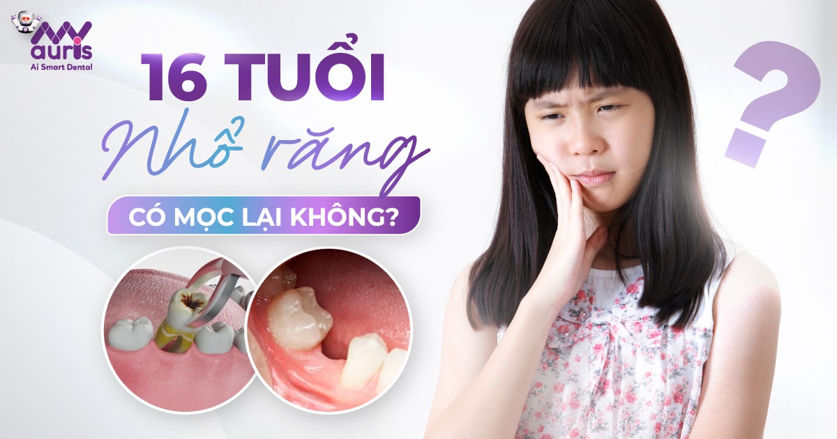 [Tư vấn nha khoa] 16 tuổi nhổ răng có mọc lại không?