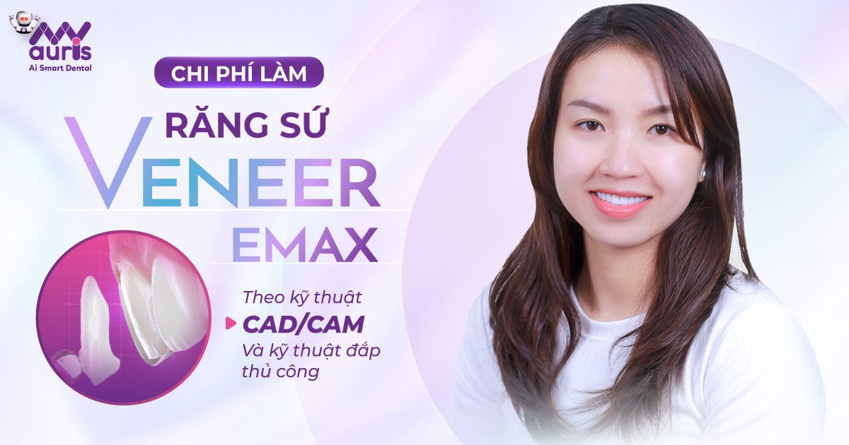 răng sứ veneer emax