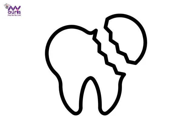 cách phục hồi răng bị mẻ tại nhà 