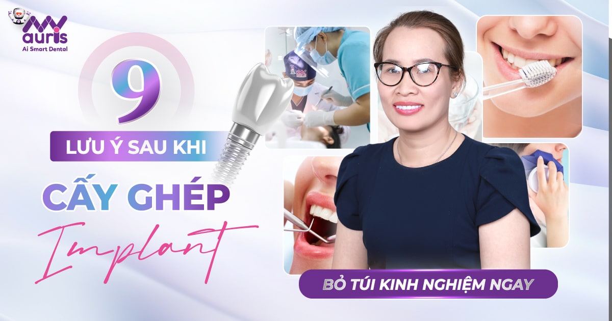 9 lưu ý sau khi cấy ghép implant