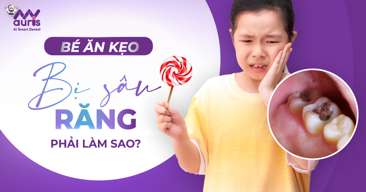 Trẻ nhỏ ăn kẹo bị sâu răng - 3 giải pháp hỗ trợ chính