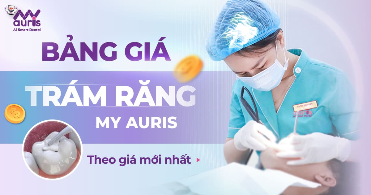 bảng giá trám răng