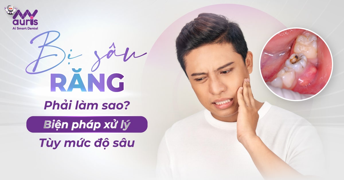 Bị sâu răng phải làm sao