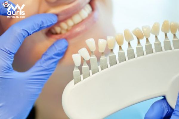 Tuổi thọ của các mão răng sứ sẽ phục thuộc vào yếu tố nào?