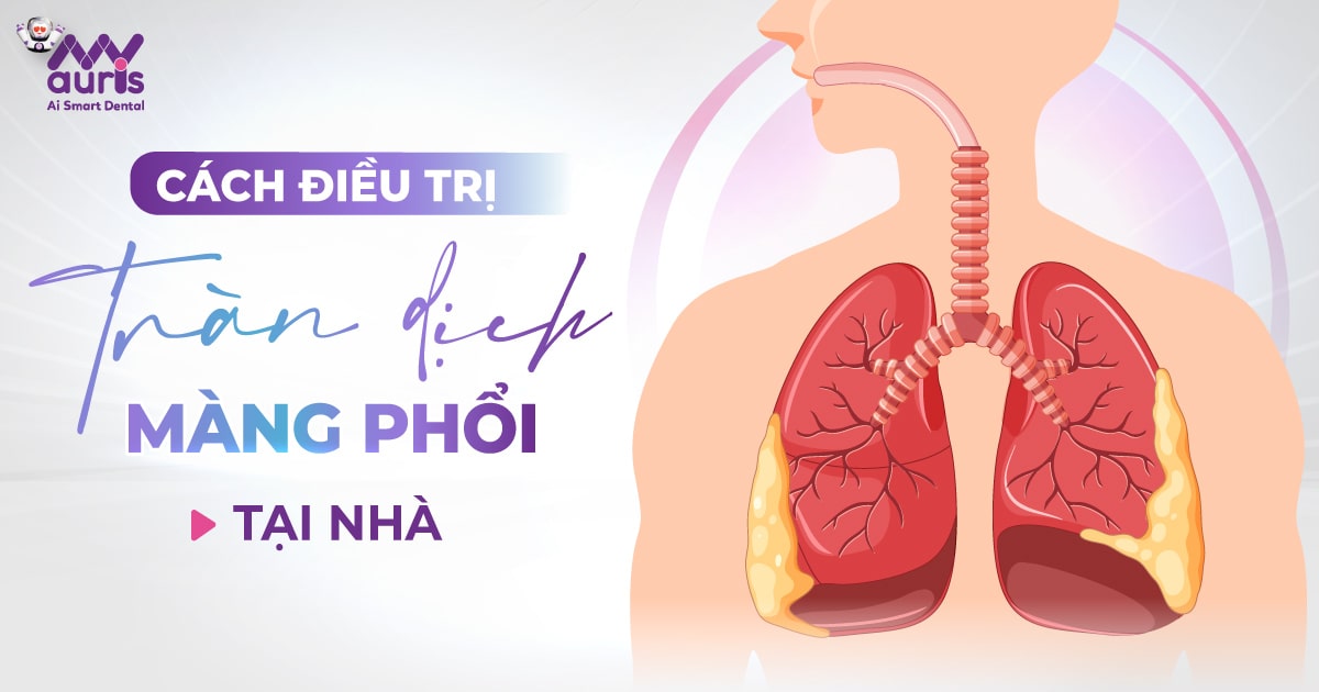 [Tìm hiểu] Cách điều trị tràn dịch màng phổi tại nhà