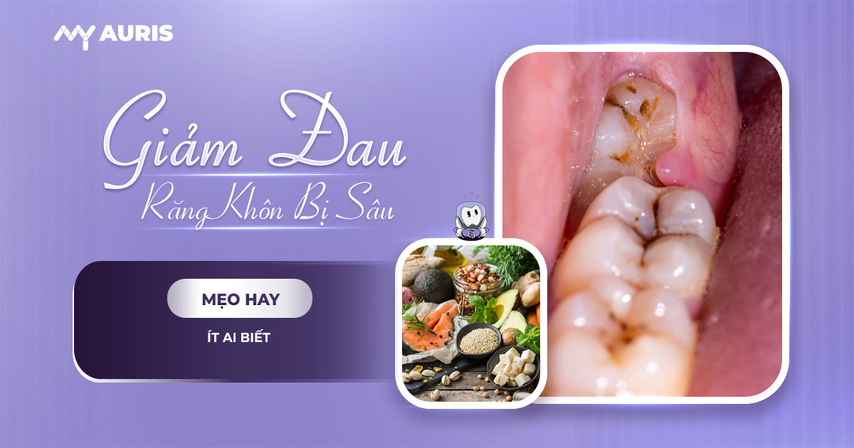 Cách giảm đau răng khôn bị sâu