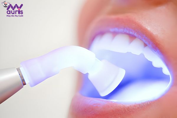 Cách làm trắng răng tại các nha khoa 