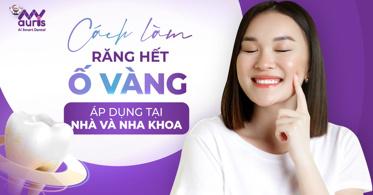 7 cách làm răng hết ố vàng ở nhà và nha khoa hiệu quả