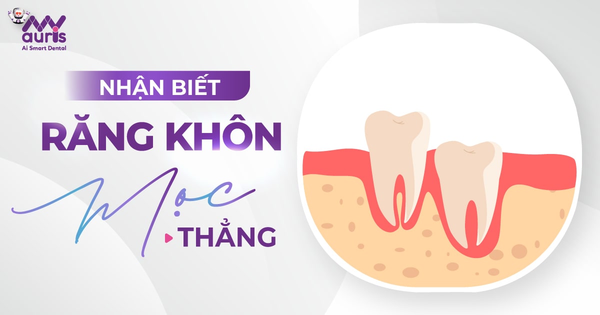 [Hướng dẫn] Cách nhận biết răng khôn mọc thẳng