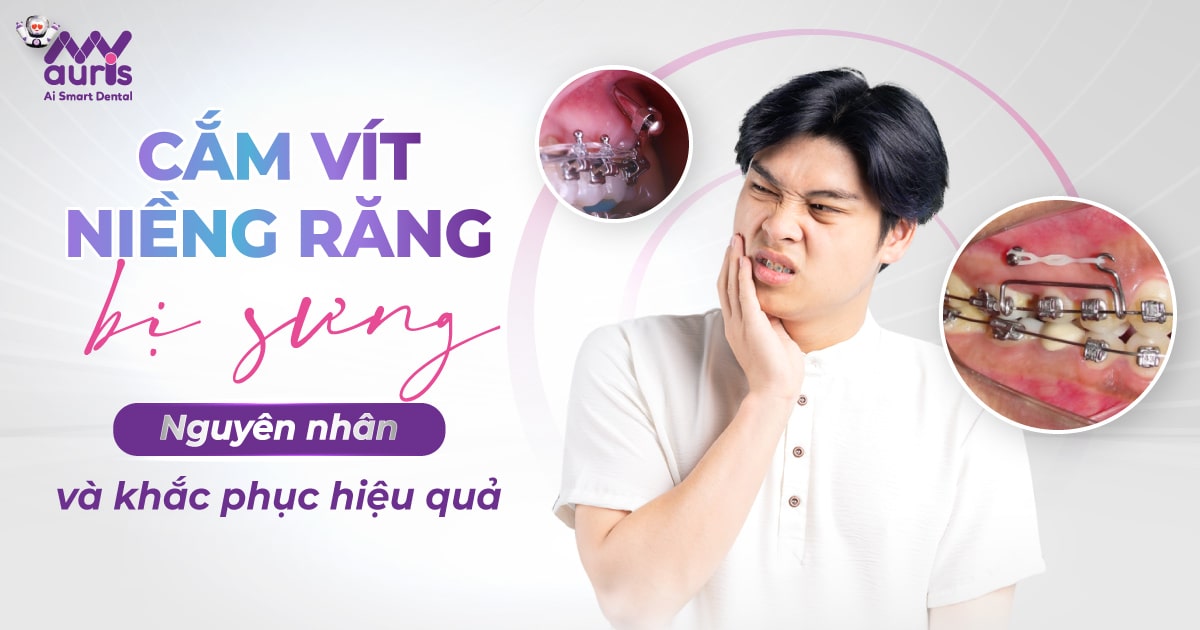 Cắm vít niềng răng bị sưng