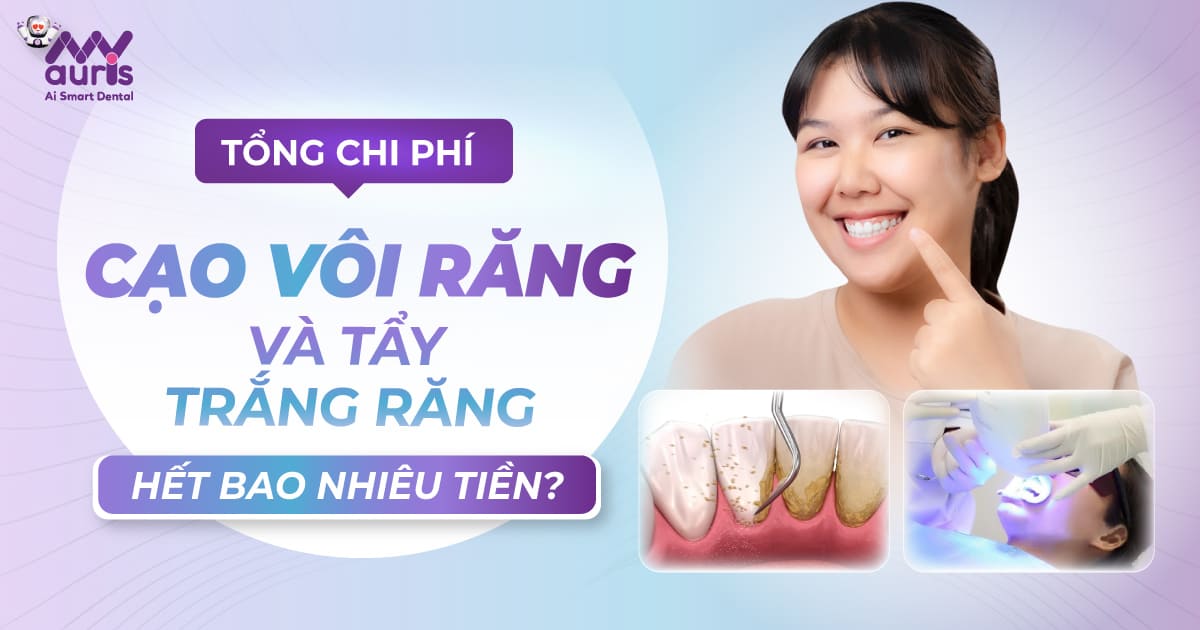 cạo vôi răng