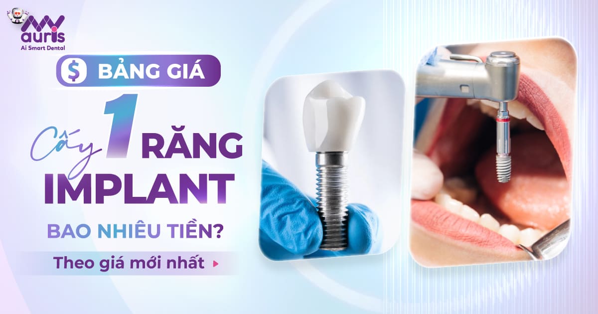 1 cây răng implant bao nhiêu tiền