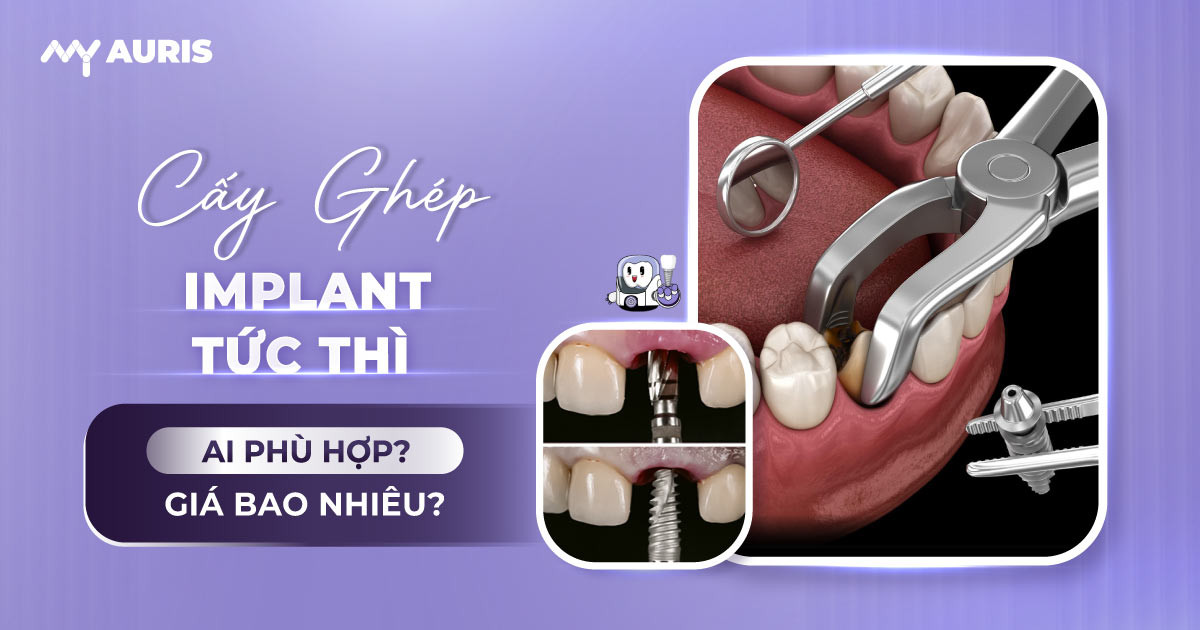 cấy ghép implant tức thì,cấy ghép implant,cấy implant,cắm implant,cắm implant sau nhổ răng,tức thì
