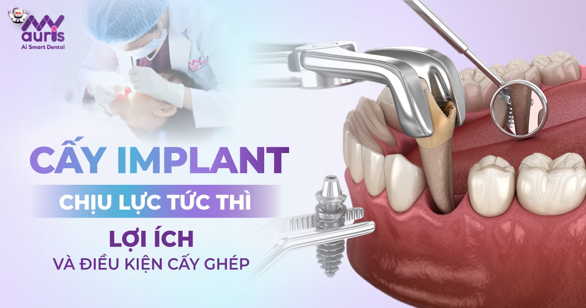 Cấy implant chịu lực tức thì